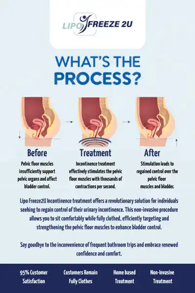 Diagram of how incontinence treatment Hammersmith works.