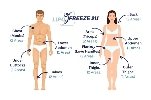 Areas you can have fat freezing treatment Hammersmith
