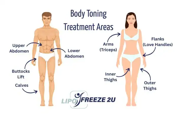 Graphic showing where you can have Body toning Treatment Hammersmith on your body