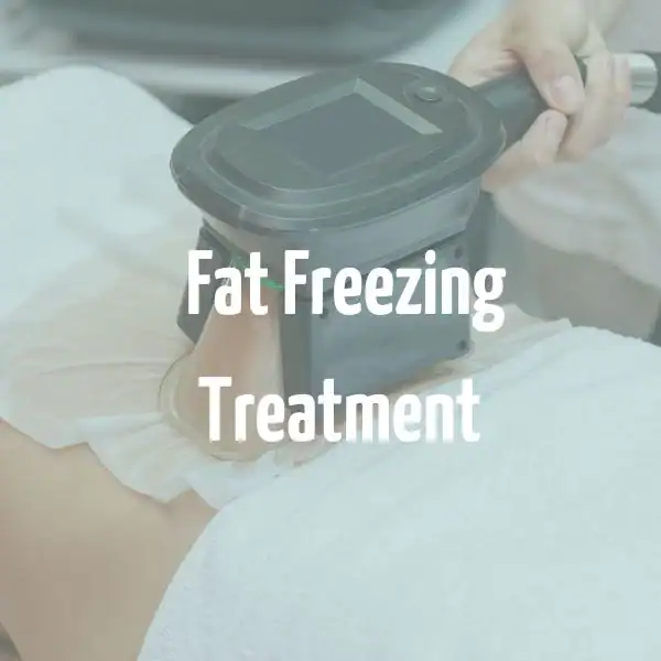 fat freezing treatment Hammersmith