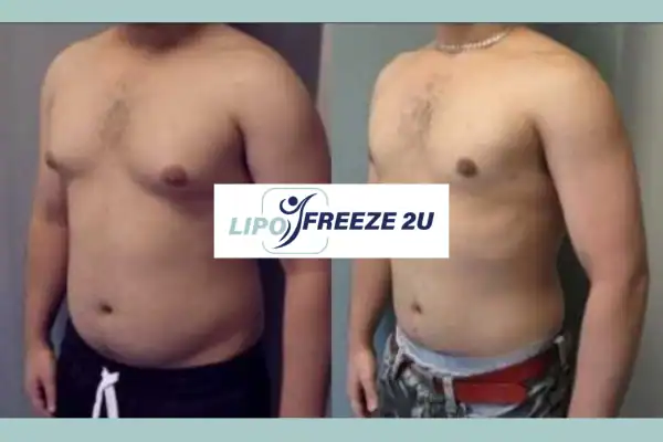 How Long Does It Take to See Results Hammersmith?